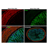 Rabbit IgG (H+L) Secondary Antibody in Immunohistochemistry (Paraffin) (IHC (P))