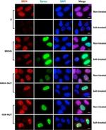 Xpress Antibody in Immunocytochemistry (ICC/IF)