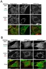 Myc Tag Antibody in Immunocytochemistry (ICC/IF)