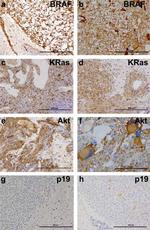 V5 Tag Antibody in Immunohistochemistry (IHC)