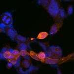 Kappa Opioid Receptor Antibody in Immunocytochemistry (ICC/IF)