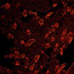 Mu Opioid Receptor Antibody in Immunohistochemistry (IHC)