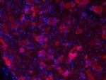 P2X3 Antibody in Immunocytochemistry (ICC/IF)