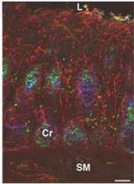 PGP9.5 Antibody in Immunohistochemistry (IHC)