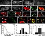 NPY Y2 Receptor Antibody in Immunohistochemistry (IHC)