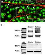 VR1 C-Terminus (TRPV1) - mouse specific Antibody in Immunohistochemistry (IHC)