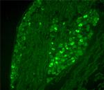 VR1 C-Terminus (TRPV1) - mouse specific Antibody in Immunohistochemistry (IHC)