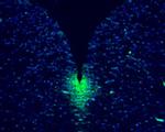 Musashi-1 Antibody in Immunohistochemistry (IHC)