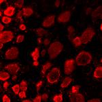 ASIC 2B 15-26 Antibody in Immunohistochemistry (IHC)