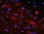 ORL 1 Antibody in Immunohistochemistry (IHC)