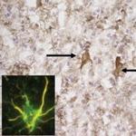 PTEN-induced kinase/PINK1 Antibody in Immunohistochemistry (IHC)