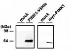 PTEN-induced kinase/PINK1 Antibody in Western Blot (WB)