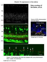 SHANK1a C-terminus Antibody in Immunohistochemistry (IHC)
