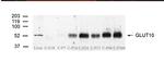 GLUT10 Antibody in Western Blot (WB)