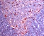 Alpha 2c Adrenergic Receptor Antibody in Immunohistochemistry (IHC)
