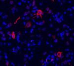 mGluR1 alpha Antibody in Immunocytochemistry (ICC/IF)