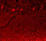 Notch3 Antibody in Immunohistochemistry (IHC)