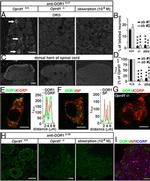 Delta Opioid Receptor 3-17 Antibody in Immunohistochemistry (IHC)