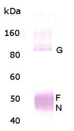 Respiratory Syncytial Virus (RSV) Antibody in Western Blot (WB)