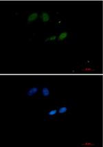 UBE2I Recombinant Rabbit Monoclonal Antibody