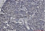 STAT5B Antibody in Immunohistochemistry (Paraffin) (IHC (P))