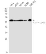 SQSTM1 Antibody in Western Blot (WB)