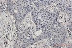 SMARCA2 Antibody in Immunohistochemistry (Paraffin) (IHC (P))