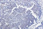 SMAD3 Recombinant Rabbit Monoclonal Antibody
