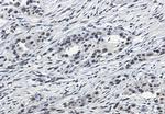SF3B1 Antibody in Immunohistochemistry (Paraffin) (IHC (P))