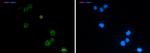 SEMA4D Recombinant Rabbit Monoclonal Antibody