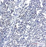 RPS20 Recombinant Rabbit Monoclonal Antibody