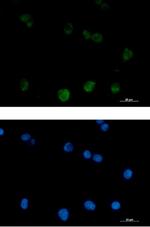 PRKCB Recombinant Rabbit Monoclonal Antibody
