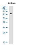 PRKCB Antibody in Western Blot (WB)