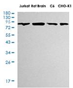 PIK3R1 Antibody in Western Blot (WB)
