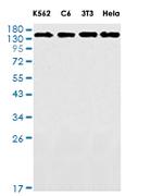 EIF2AK3 Recombinant Rabbit Monoclonal Antibody