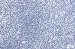 HMGB1 Recombinant Rabbit Monoclonal Antibody