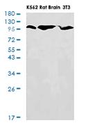 HK2 Antibody in Western Blot (WB)