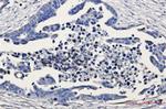 GSK3B Antibody in Immunohistochemistry (Paraffin) (IHC (P))