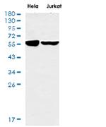 FTO Recombinant Rabbit Monoclonal Antibody