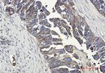 CDH1 Antibody in Immunohistochemistry (Paraffin) (IHC (P))