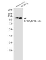 DGKZ Recombinant Rabbit Monoclonal Antibody