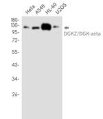 DGKZ Recombinant Rabbit Monoclonal Antibody