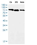 CTNND1 Recombinant Rabbit Monoclonal Antibody