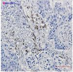 PTGS2 Antibody in Immunohistochemistry (Paraffin) (IHC (P))