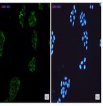 COL3A1 Recombinant Rabbit Monoclonal Antibody