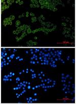 COL1A1 Antibody in Immunocytochemistry (ICC/IF)