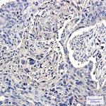 CCT2 Recombinant Rabbit Monoclonal Antibody