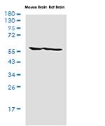 CCT2 Antibody in Western Blot (WB)