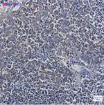 TUBB Recombinant Rabbit Monoclonal Antibody