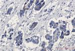 CTNNB1 Antibody in Immunohistochemistry (Paraffin) (IHC (P))